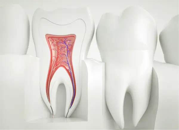 Root Canals & Infections